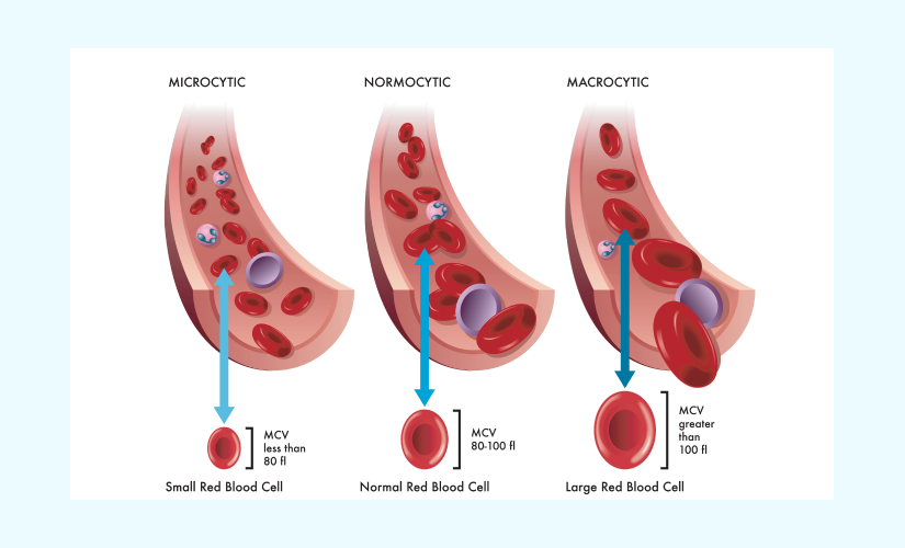 Mean Cell Volume (MCV) in Hindi Explained