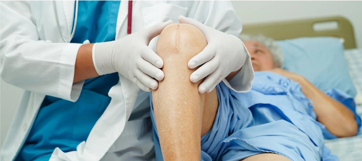 Joint Replacement Surgery in Delhi: Expert Orthopaedic Care by Dr. Anant Kumar Tiwari