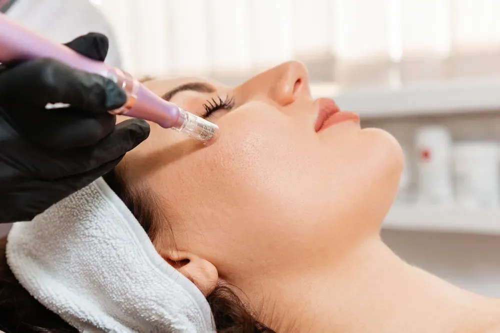 Revitalize Your Skin: Vampire Facial in Islamabad for Natural Glow