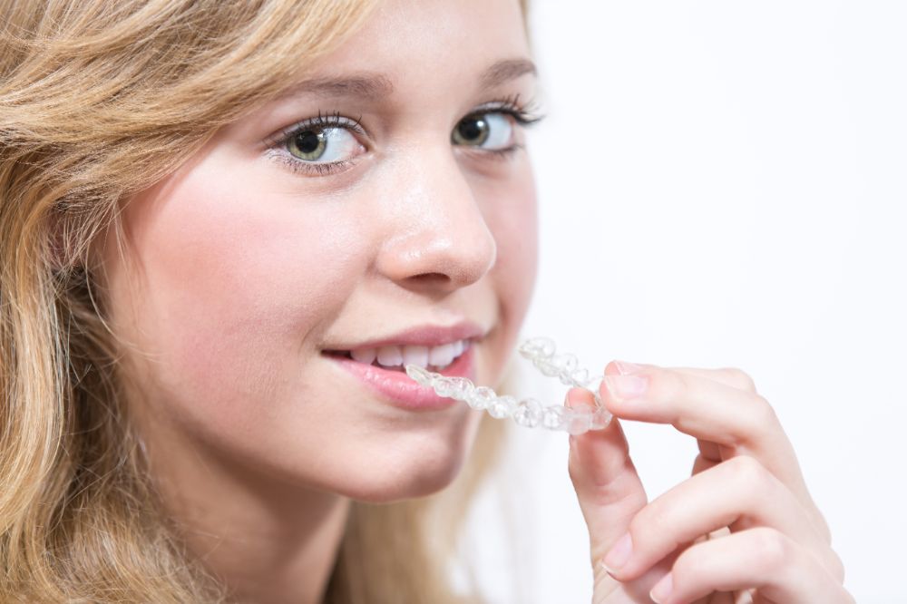 Dental Braces – Types, Components, Procedure, and Clinical