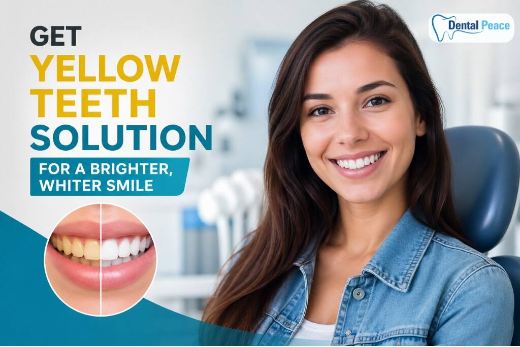 Complete Guide to Yellow Teeth Solution with Dental Peace