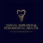 Dental Implants Periodontal Health Profile Picture