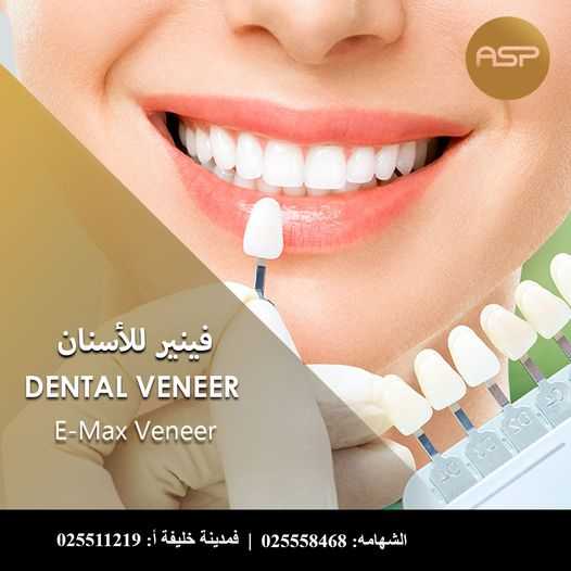 Dental Veneer in Abu Dhabi