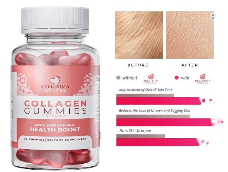 Bellisima Bites Collagen Gummies USA Benefits, Reviews &amp; Final Words [2023]