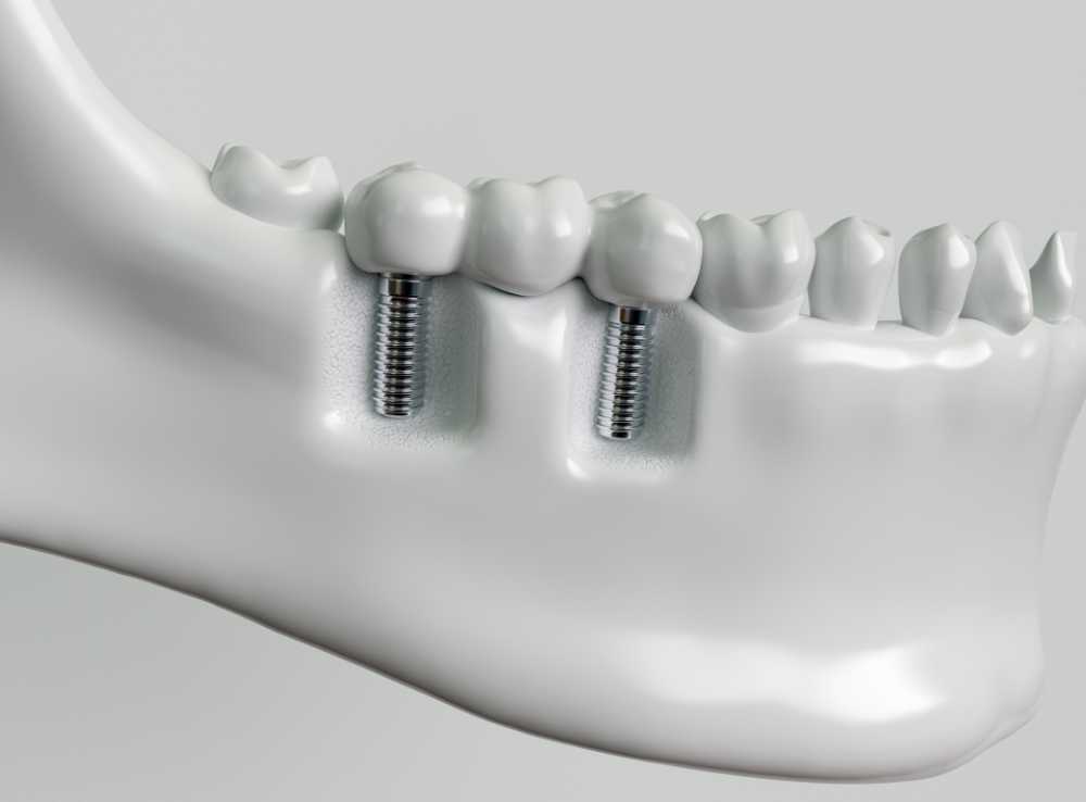 Roy Morris Dental Excellence