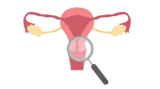 Everything You Need to Know About Intramural Leiomyomas: Symptoms, Causes, and Treatment Options